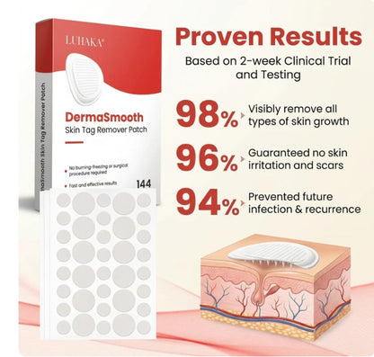 DermaSmooth™ - Tag & Mole Remover Patches ❤️🩹 | Buy 1 Get 1 Free ✨